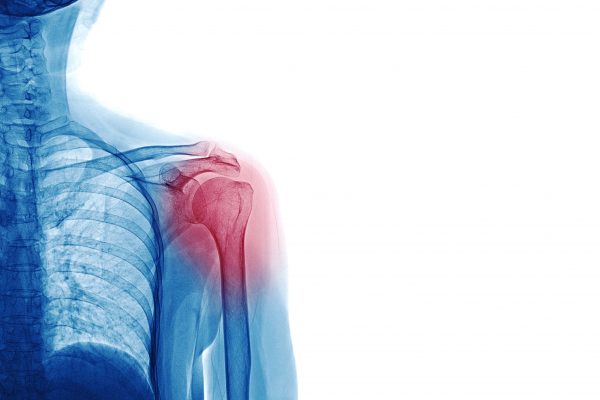 pain relief, pain management, pain, natural ways to manage pain, natural health, light therapy, bowen therapy, yoga, pilates, meditation, detox, beaconsfield, wellness